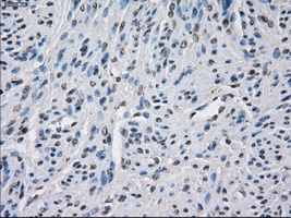 BUB1B / BubR1 Antibody - IHC of paraffin-embedded endometrium tissue using anti-BUB1B mouse monoclonal antibody. (Dilution 1:50).