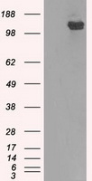 BUB1B / BubR1 Antibody - HEK293T cells were transfected with the pCMV6-ENTRY control (Left lane) or pCMV6-ENTRY BUB1B (Right lane) cDNA for 48 hrs and lysed. Equivalent amounts of cell lysates (5 ug per lane) were separated by SDS-PAGE and immunoblotted with anti-BUB1B.