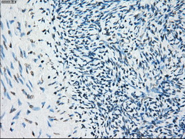 BUB1B / BubR1 Antibody - IHC of paraffin-embedded Ovary tissue using anti-BUB1B mouse monoclonal antibody. (Dilution 1:50).
