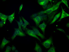 BUB1B / BubR1 Antibody - Immunofluorescent staining of HeLa cells using anti-BUB1B mouse monoclonal antibody.