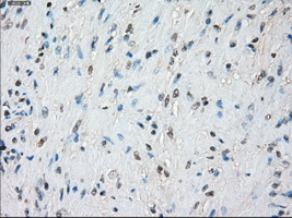 BUB1B / BubR1 Antibody - IHC of paraffin-embedded prostate tissue using anti-BUB1B mouse monoclonal antibody. (Dilution 1:50).