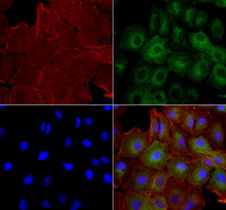 BUB1B / BubR1 Antibody - Immunofluorescent staining of A549 cells using anti-BUB1B mouse monoclonal antibody  green). Actin filaments were labeled with TRITC-phalloidin. (red), and nuclear with DAPI. (blue). The three-color overlay image is located at the bottom-right corner.