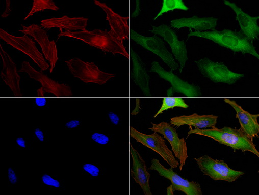 BUB1B / BubR1 Antibody - Immunofluorescent staining of HeLa cells using anti-BUB1B mouse monoclonal antibody  green). Actin filaments were labeled with TRITC-phalloidin. (red), and nuclear with DAPI. (blue). The three-color overlay image is located at the bottom-right corner.