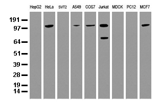 BUB1B / BubR1 Antibody - Western blot analysis of extracts. (35ug) from 9 different cell lines by using anti-BUB1B monoclonal antibody. (Clone UMAB7) at 1:500.