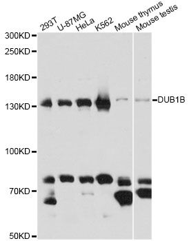 BUB1B / BubR1 Antibody - Western blot analysis of extracts of various cell lines, using BUB1B antibody at 1:1000 dilution. The secondary antibody used was an HRP Goat Anti-Rabbit IgG (H+L) at 1:10000 dilution. Lysates were loaded 25ug per lane and 3% nonfat dry milk in TBST was used for blocking. An ECL Kit was used for detection and the exposure time was 10s.