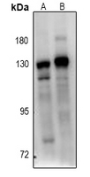 BUB1B / BubR1 Antibody - Western blot analysis of BUB1B expression in Hela (A), A549 (B) whole cell lysates.