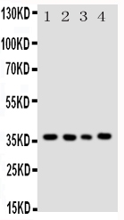 BUB3 Antibody - Anti-Bub3 antibody, Western blotting All lanes: Anti Bub3 at 0.5ug/ml Lane 1: HELA Whole Cell Lysate at 40ugLane 2: A549 Whole Cell Lysate at 40ugLane 3: JURKAT Whole Cell Lysate at 40ugLane 4: COLO320 Whole Cell Lysate at 40ugPredicted bind size: 37KD Observed bind size: 37KD