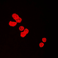 BUB3 Antibody - Immunofluorescent analysis of BUB3 staining in HeLa cells. Formalin-fixed cells were permeabilized with 0.1% Triton X-100 in TBS for 5-10 minutes and blocked with 3% BSA-PBS for 30 minutes at room temperature. Cells were probed with the primary antibody in 3% BSA-PBS and incubated overnight at 4 C in a humidified chamber. Cells were washed with PBST and incubated with a DyLight 594-conjugated secondary antibody (red) in PBS at room temperature in the dark. DAPI was used to stain the cell nuclei (blue).