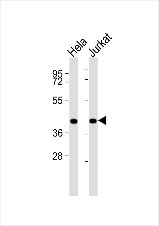 BUB3 Antibody - All lanes : Anti-BUB3 Antibody at 1:1000 dilution Lane 1: HeLa whole cell lysates Lane 2: Jurkat whole cell lysates Lysates/proteins at 20 ug per lane. Secondary Goat Anti-Rabbit IgG, (H+L),Peroxidase conjugated at 1/10000 dilution Predicted band size : 37 kDa Blocking/Dilution buffer: 5% NFDM/TBST.