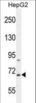 BUD13 Antibody - BUD13 Antibody western blot of HepG2 cell line lysates (35 ug/lane). The BUD13 antibody detected the BUD13 protein (arrow).