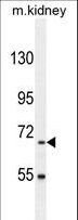 BUD13 Antibody - BUD13 Antibody western blot of mouse kidney tissue lysates (35 ug/lane). The BUD13 antibody detected the BUD13 protein (arrow).