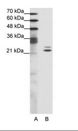 BUD31 Antibody - A: Marker, B: Jurkat Cell Lysate.  This image was taken for the unconjugated form of this product. Other forms have not been tested.