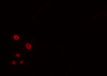 BUD31 Antibody - Staining HeLa cells by IF/ICC. The samples were fixed with PFA and permeabilized in 0.1% Triton X-100, then blocked in 10% serum for 45 min at 25°C. The primary antibody was diluted at 1:200 and incubated with the sample for 1 hour at 37°C. An Alexa Fluor 594 conjugated goat anti-rabbit IgG (H+L) antibody, diluted at 1/600, was used as secondary antibody.