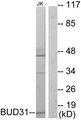 BUD31 Antibody - Western blot analysis of extracts from Jurkat cells, using BUD31 antibody.