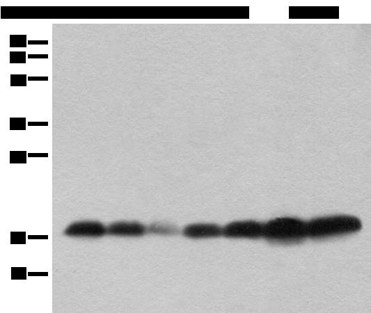 BUD31 Antibody - Western Blot analysis of Human testis,Mouse brain,Mouse heart,PC-3 cell,231 cell,Raji and Jurkat cell lysates Mouse lung and Rat spleen using BUD31 Polyclonal Antibody at dilution of 1:800.