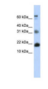 BUD31 Antibody - BUD31 antibody Western blot of Transfected 293T cell lysate. This image was taken for the unconjugated form of this product. Other forms have not been tested.