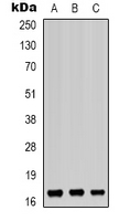 BUD31 Antibody - Western blot analysis of BUD31 expression in K562 (A); HepG2 (B); Jurkat (C) whole cell lysates.