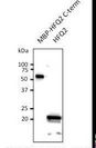Burkholderia cenocepacia Hfq2 Antibody - Anti-HFO2 antibody at 1:500 dilution. 50 ng ug of protein per lane and 100 ug of total Protein (Burkholderia cell lysate). Rabbit polyclonal to goat IgG (HRP) at 1:10000 dilution.