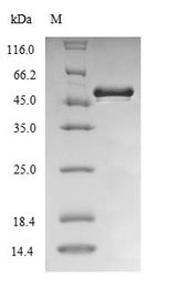 lpxC / asmB / envA Protein - (Tris-Glycine gel) Discontinuous SDS-PAGE (reduced) with 5% enrichment gel and 15% separation gel.