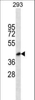 BVES Antibody - BVES Antibody western blot of 293 cell line lysates (35 ug/lane). The BVES antibody detected the BVES protein (arrow).