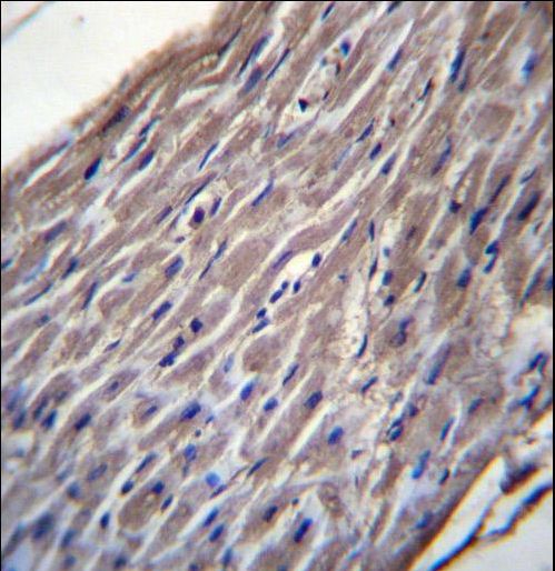 BVES Antibody - BVES Antibody immunohistochemistry of formalin-fixed and paraffin-embedded human heart tissue followed by peroxidase-conjugated secondary antibody and DAB staining.