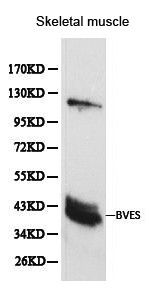 BVES Antibody - Western blot of BVES pAb in extracts from mouse skeletal muscle tissue.