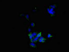 BVES Antibody - Immunofluorescent analysis of 293 cells diluted at 1:100 and Alexa Fluor 488-congugated AffiniPure Goat Anti-Rabbit IgG(H+L)