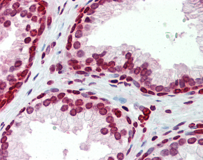 BXDC5 / RPF1 Antibody - Anti-RPF1 / BXDC5 antibody IHC of human prostate. Immunohistochemistry of formalin-fixed, paraffin-embedded tissue after heat-induced antigen retrieval. Antibody concentration 5 ug/ml.  This image was taken for the unconjugated form of this product. Other forms have not been tested.