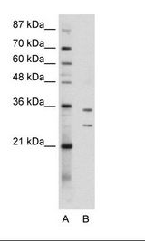 BXDC5 / RPF1 Antibody - K562 Cell Lysate.  This image was taken for the unconjugated form of this product. Other forms have not been tested.