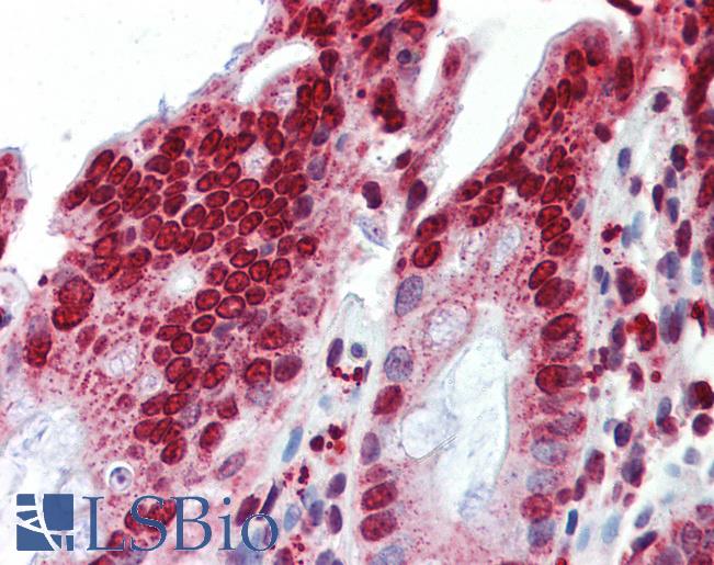 BXDC5 / RPF1 Antibody - Anti-RPF1 / BXDC5 antibody IHC of human colon. Immunohistochemistry of formalin-fixed, paraffin-embedded tissue after heat-induced antigen retrieval. Antibody concentration 5 ug/ml.  This image was taken for the unconjugated form of this product. Other forms have not been tested.