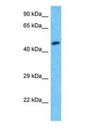 BYSL Antibody - Western blot of BYST Antibody with human COLO205 Whole Cell lysate.  This image was taken for the unconjugated form of this product. Other forms have not been tested.