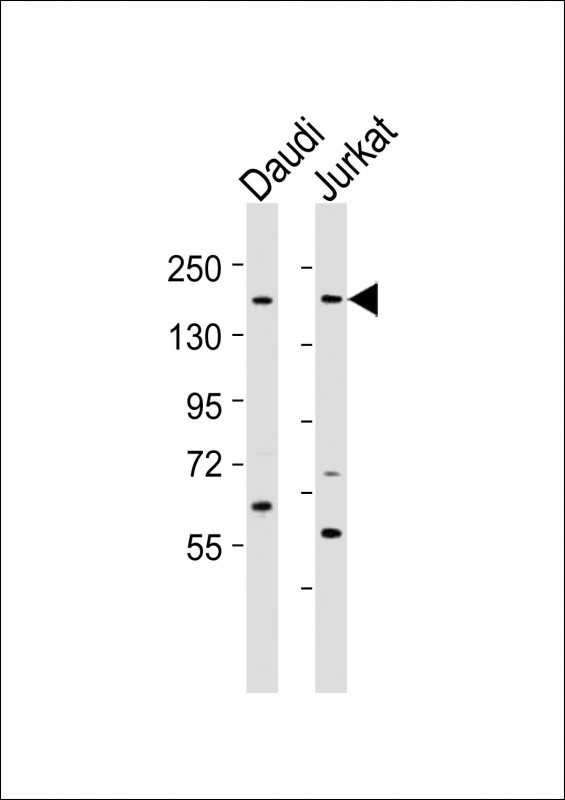 BZRAP1 / PRAX-1 Antibody - All lanes : Anti-BZRAP1 Antibody at 1:2000 dilution Lane 1: Daudi whole cell lysates Lane 2: Jurkat whole cell lysates Lysates/proteins at 20 ug per lane. Secondary Goat Anti-Rabbit IgG, (H+L), Peroxidase conjugated at 1/10000 dilution Predicted band size : 200 kDa Blocking/Dilution buffer: 5% NFDM/TBST.