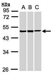 BZW2 Antibody - Sample (30 ug whole cell lysate). A: A431, B: HeLa S3, C: MOLT4 . 10% SDS PAGE. BZW2 antibody diluted at 1:1000