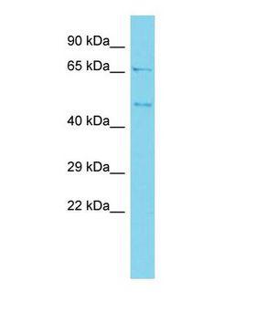 BZW2 Antibody - Western blot of BZW2 Antibody - N-terminal region with human ACHN cells lysate.  This image was taken for the unconjugated form of this product. Other forms have not been tested.