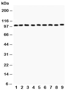 c-CBL Antibody - Western blot testing of CBL antibody (0.5ug/ml) and Lane 1: HeLa; 2: MCF-7; 3: HepG2; 4: Colo320; 5: PANC; 6: SW620; 7: A549; 8: Skov; 9: HT1080 lysate