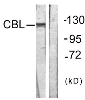 c-CBL Antibody - Western blot analysis of lysates from HepG2 cells, treated with Na2VO3 0.3nM 40', using CBL Antibody. The lane on the right is blocked with the synthesized peptide.