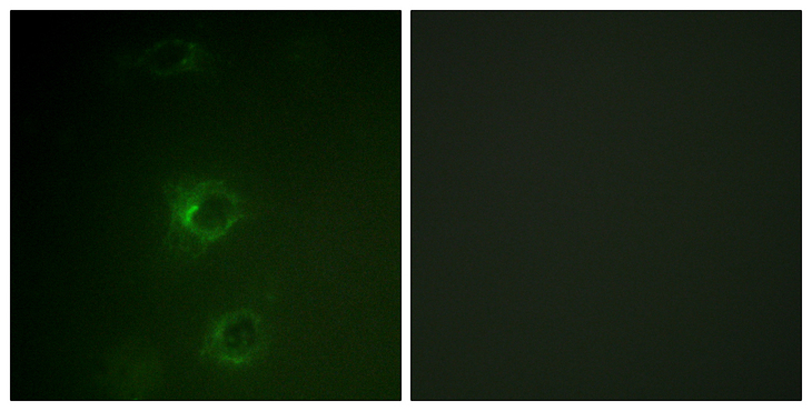 c-CBL Antibody - Immunofluorescence analysis of COS7 cells, using CBL Antibody. The picture on the right is blocked with the synthesized peptide.