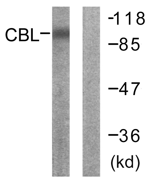 c-CBL Antibody - Western blot analysis of lysates from 293 cells, using CBL Antibody. The lane on the right is blocked with the synthesized peptide.