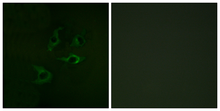c-CBL Antibody - Immunofluorescence analysis of A549 cells, using CBL Antibody. The picture on the right is blocked with the synthesized peptide.