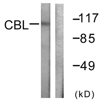 c-CBL Antibody - Western blot analysis of lysates from HeLa cells, treated with EGF 200ng/ml 30', using CBL Antibody. The lane on the right is blocked with the synthesized peptide.