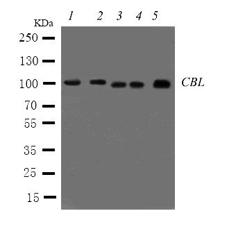 c-CBL Antibody - WB of c-CBL antibody. Lane 1: Rat Testis Tissue Lysate. Lane 2: Rat Liver Tissue Lysate. Lane 3: MCF-7 Cell Lysate. Lane 4: M231 Cell Lysate. Lane 5: HELA Cell Lysate.