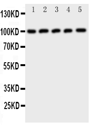 c-CBL Antibody - Anti-CBL antibody, Western blotting All lanes: Anti CBL at 0.5ug/ml Lane 1: Rat Testis Tissue Lysate at 50ug Lane 2: Rat Liver Tissue Lysate at 50ug Lane 3: MCF-7 Whole Cell Lysate at 40ug Lane 4: M231 Whole Cell Lysate at 40ug Lane 5: HELA Whole Cell Lysate at 40ug Predicted bind size: 100KD Observed bind size: 100KD