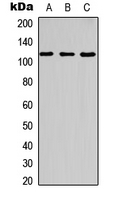 c-CBL Antibody - Western blot analysis of c-CBL (pY700) expression in HT29 UV-treated (A); NIH3T3 (B); rat kidney (C) whole cell lysates.