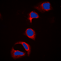 c-CBL Antibody - Immunofluorescent analysis of c-CBL (pY700) staining in HeLa cells. Formalin-fixed cells were permeabilized with 0.1% Triton X-100 in TBS for 5-10 minutes and blocked with 3% BSA-PBS for 30 minutes at room temperature. Cells were probed with the primary antibody in 3% BSA-PBS and incubated overnight at 4 deg C in a humidified chamber. Cells were washed with PBST and incubated with a DyLight 594-conjugated secondary antibody (red) in PBS at room temperature in the dark. DAPI was used to stain the cell nuclei (blue).