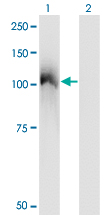 c-CBL Antibody - Western Blot analysis of CBL expression in transfected 293T cell line by CBL monoclonal antibody (M01), clone 6D12.Lane 1: CBL transfected lysate (Predicted MW: 99.6 KDa).Lane 2: Non-transfected lysate.
