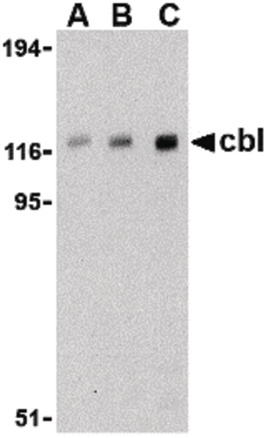 c-CBL Antibody - Western blot of cbl in Daudi cell lysate with cbl antibody at (A) 0.5, (B) 1, and (C) 2 ug/ml.