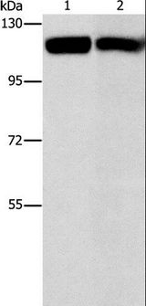 c-CBL Antibody - Western blot analysis of Raji and 231 cell, using CBL Polyclonal Antibody at dilution of 1:550.