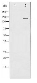 c-CBL Antibody - Western blot of CBL expression in Na2VO3 treated HepG2 whole cell lysates,The lane on the left is treated with the antigen-specific peptide.