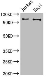 c-CBL Antibody - Positive WB detected in:Jurkat whole cell lysate,Raji whole cell lysate;All lanes:CBL antibody at 3?g/ml;Secondary;Goat polyclonal to rabbit IgG at 1/50000 dilution;Predicted band size: 100 KDa;Observed band size: 100 KDa;