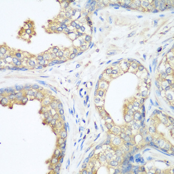c-CBL Antibody - Immunohistochemistry of paraffin-embedded human prostate using CBL antibody at dilution of 1:200 (40x lens).